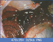 Cliquez sur l'image pour la voir en taille relle

Nom : claustridium fig 8.png
Affichages : 632
Taille : 315,3 Ko
ID : 90346