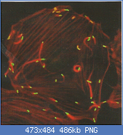 Cliquez sur l'image pour la voir en taille relle

Nom : listeria fig.2.png
Affichages : 180
Taille : 485,9 Ko
ID : 90330